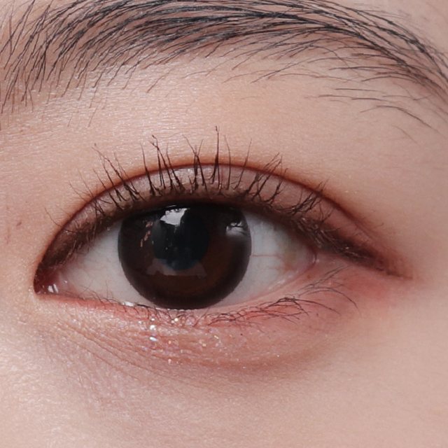 Front view of eyes 3 months after natural adhesion double eyelid surgery