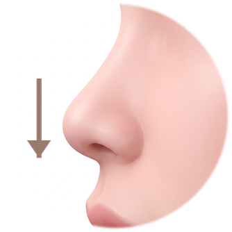 Side-profile diagram with the nasal tip pointing downward