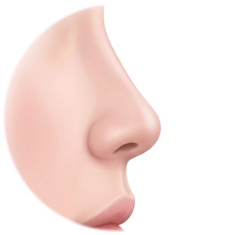 Side-profile diagram with the columella sharply descending