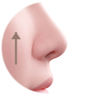 Side-profile diagram with the alar side raised upward