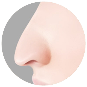 Side-profile diagram before surgery with the nasal tip drooping downward