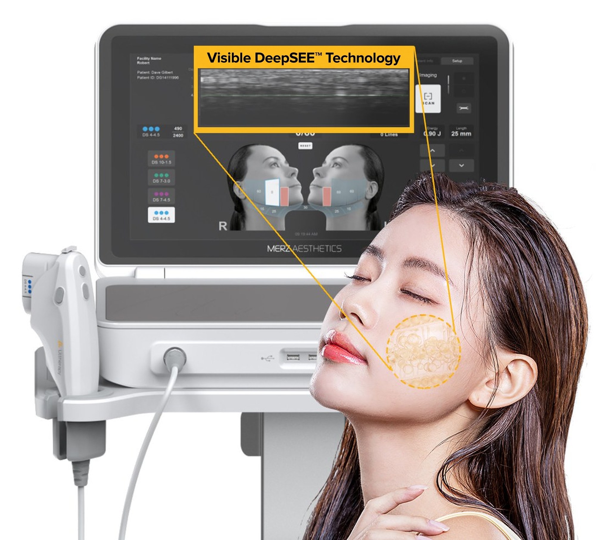 Ultrasound observation zone marked on the cheek of a female model with her eyes closed and head tilted back — the tissue beneath the skin is shown magnified