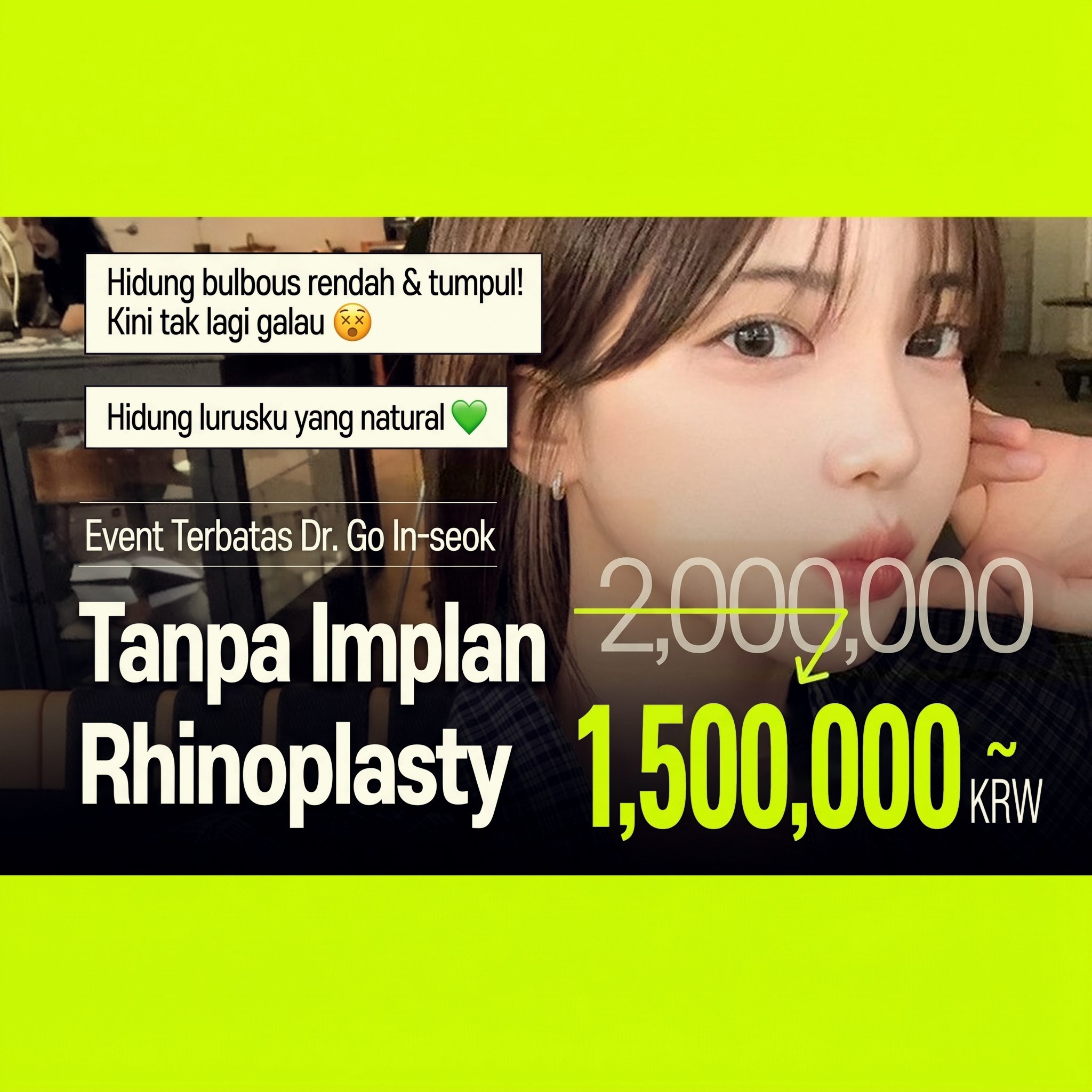 Banner event rhinoplasty pelajar tanpa implan dengan model wanita tampak samping — “Event terbatas dr. Go In⁠-⁠seok: Rhinoplasty Tanpa Implan”
