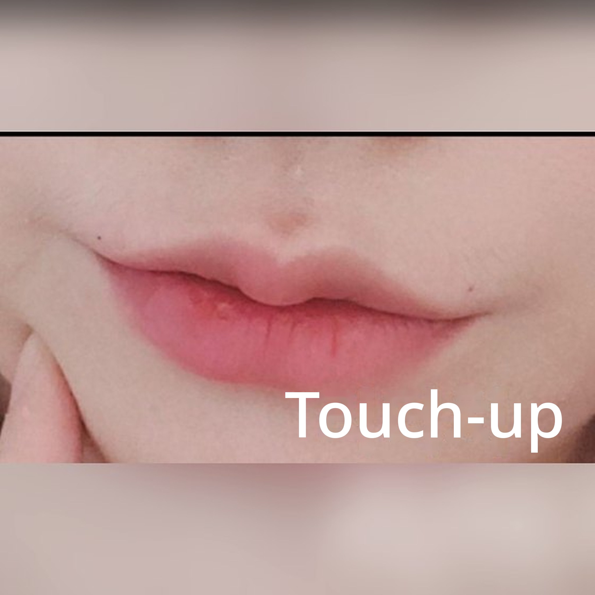 Thumbnail postingan ulasan prosedur petit — Sepertinya tempat filler bibir terbaik!! haha