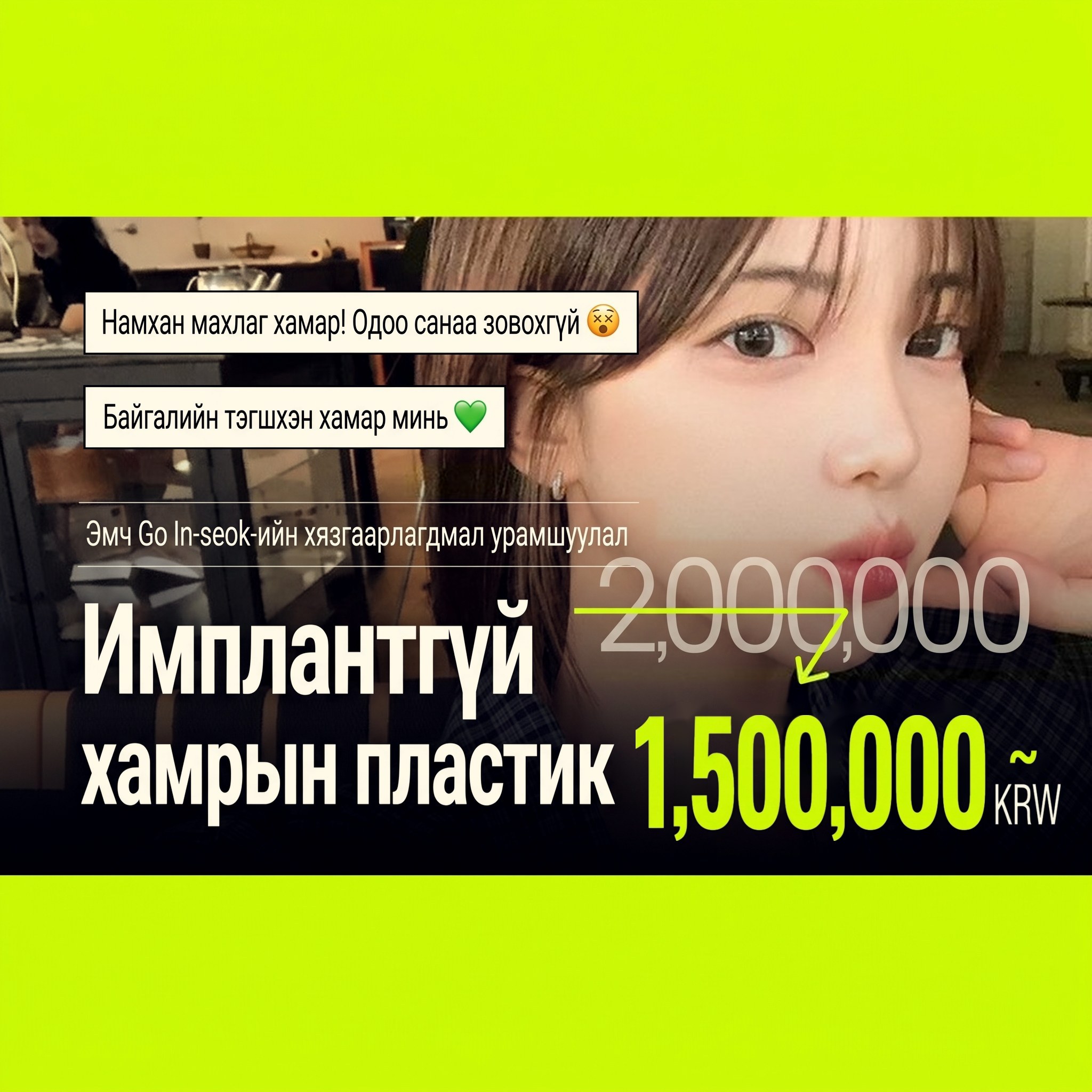 Хажуу талаасаа харагдах эмэгтэй загвар өмсөгчтэй имплантгүй оюутны хамрын пластикийн урамшууллын баннер — “Ерөнхий эмч Go In⁠-⁠seok-ийн хязгаарлагдмал урамшуулал. Имплантгүй хамрын пластик”