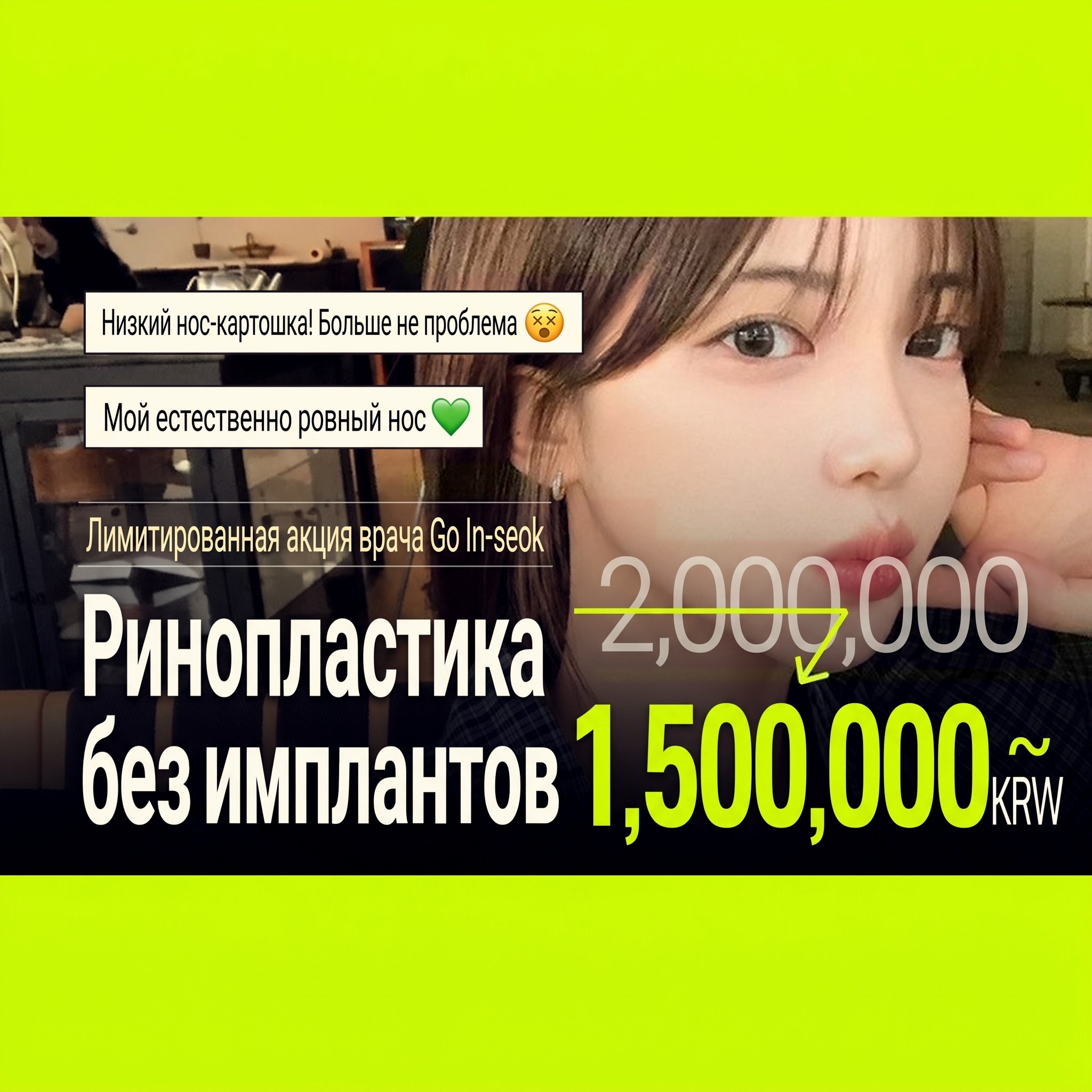 Баннер акции на ринопластику без имплантатов для студентов: женщина-модель в профиль — «Ограниченная акция главного врача Go In⁠-⁠seok. Ринопластика без имплантатов»