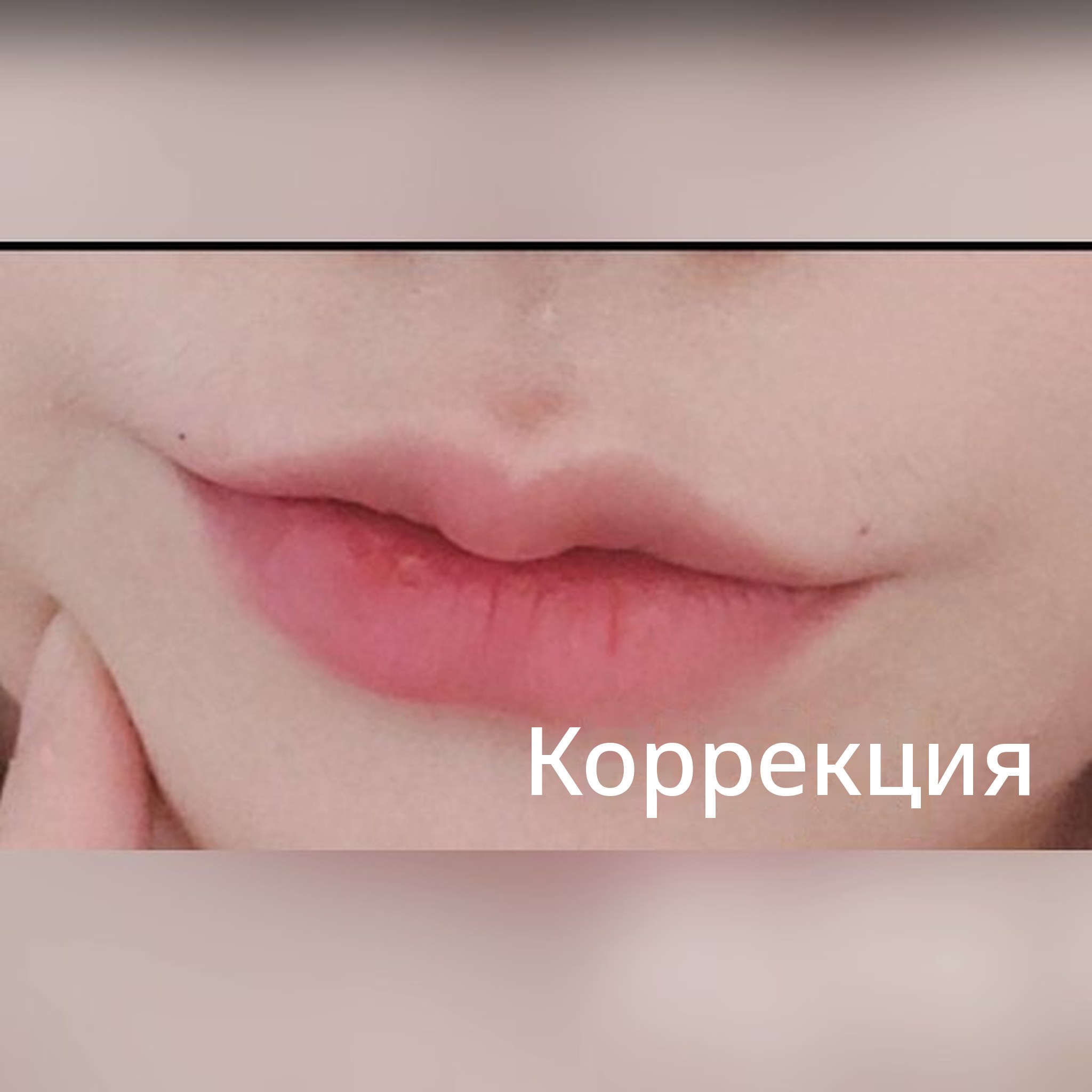 Миниатюра отзыва о малоинвазивных процедурах — Похоже, это лучшее место для филлеров в губы!