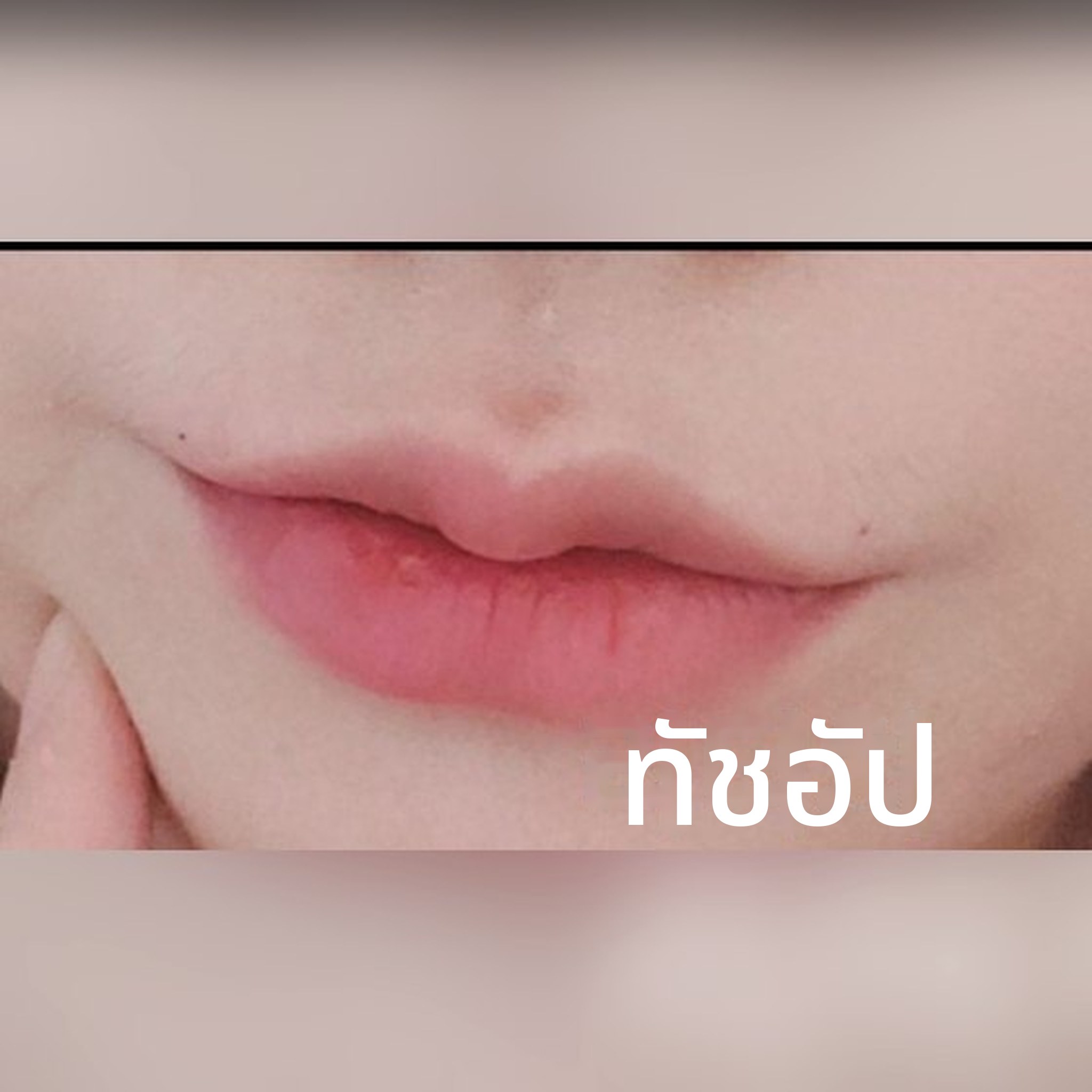 ภาพปกโพสต์รีวิวเสริมความงามแบบไม่ผ่าตัด — ที่นี่น่าจะเป็นแหล่งฟิลเลอร์ปากที่เด็ดสุดๆ!!555