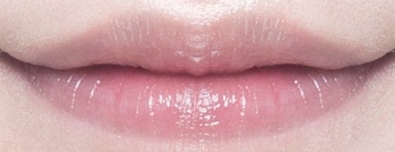 Lip diagram with the upper lip injection points enlarged