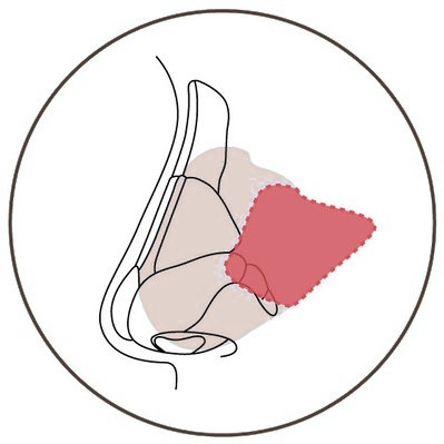 코 측면 단면에 비중격연골 위치를 표시한 일러스트