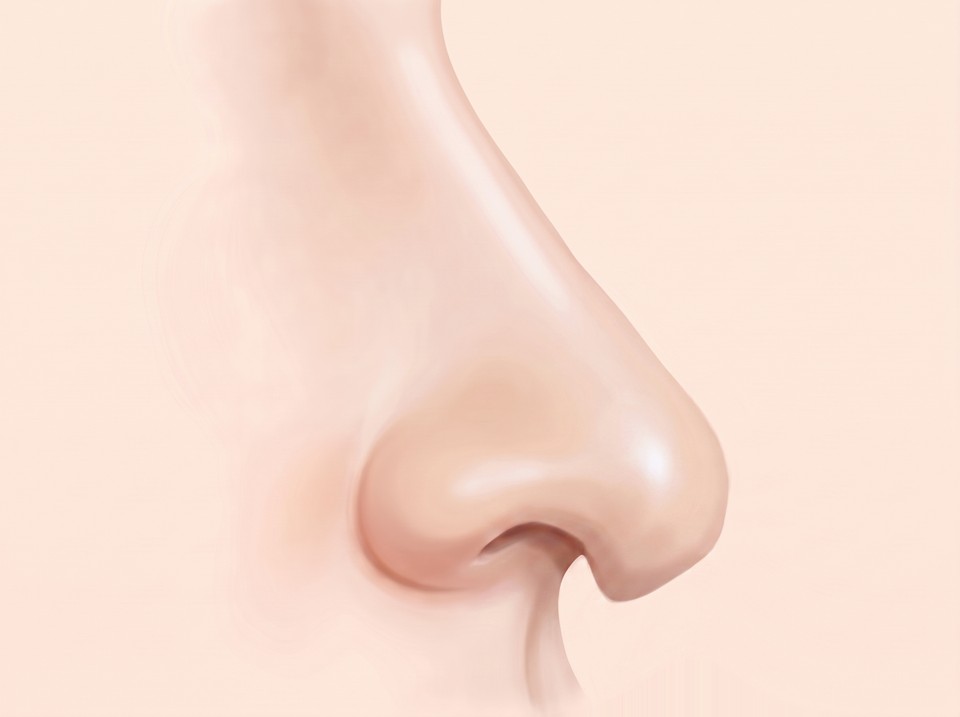 Ilustrasi hidung dilihat dari samping — ujung hidung turun dan melorot ke bawah