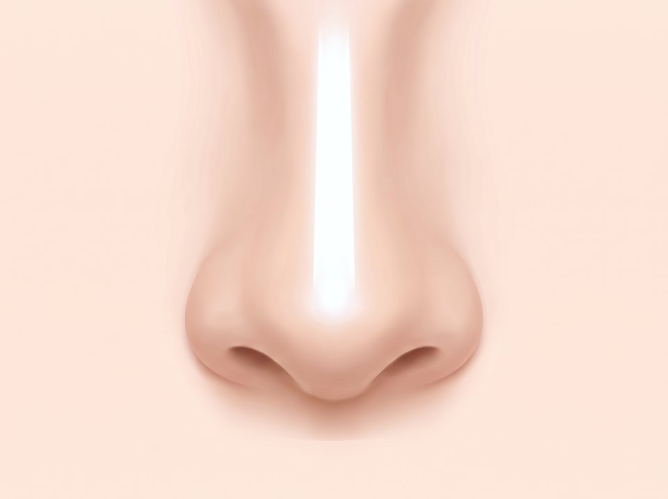 Ilustrasi hidung dilihat dari depan — kontur implan tampak menerawang di bawah kulit tipis punggung hidung