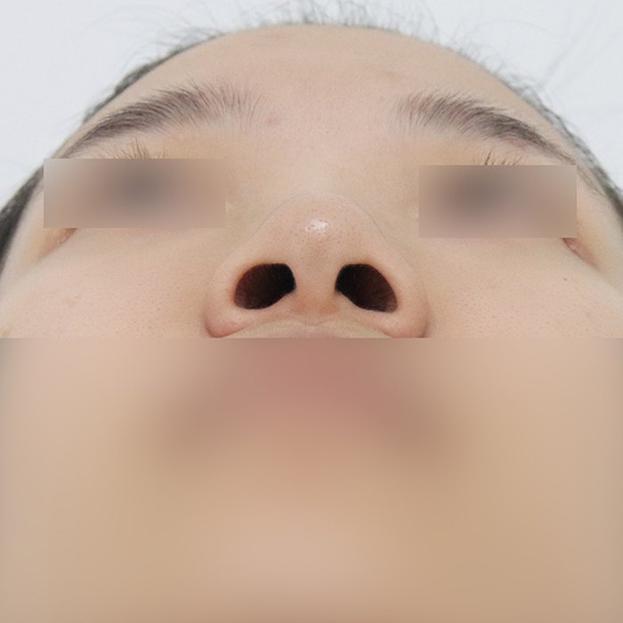 Мэс заслын өмнөх хамрын суурь