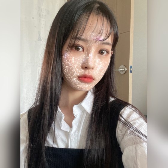 Ảnh thu nhỏ bài review phẫu thuật mắt — Review phẫu thuật làm lại mắt hai mí + phẫu thuật mũi tại Bệnh viện Thẩm mỹ Four Seasons~