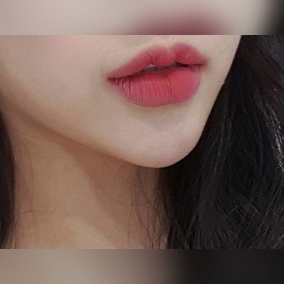 Ảnh thu nhỏ bài review thẩm mỹ không xâm lấn — Bậc thầy filler môi!!!! Four Seasons~