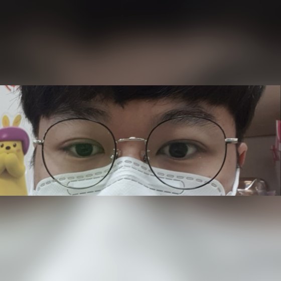 Ảnh thu nhỏ bài review phẫu thuật mắt — Để lại review phẫu thuật mắt nam