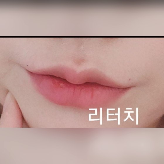 쁘띠 후기 게시글 썸네일 — 입술필러 맛집인듯요!!ㅋㅋ
