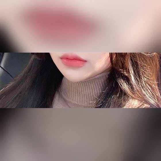 Ảnh thu nhỏ bài review thẩm mỹ không phẫu thuật — Filler môi lúc nào cũng làm ở đây!!!